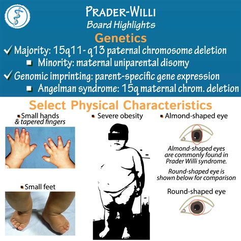 prader willi syndrome wiki|prader willi syndrome diagram.